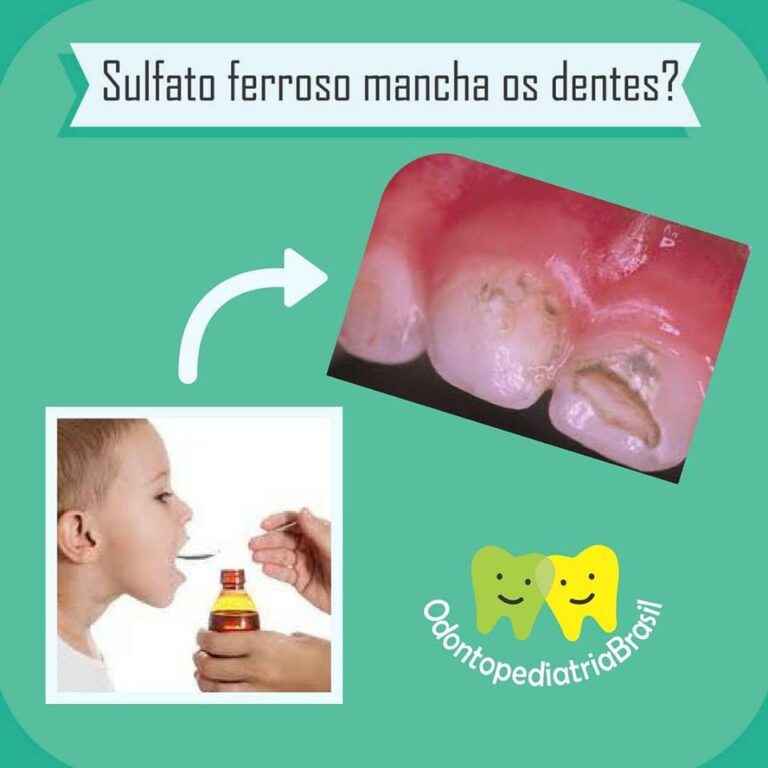 Sulfato ferroso mancha os dentes? – Odontopediatria Brasil